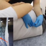 manuel terapi ile bel fıtığı tedavisi